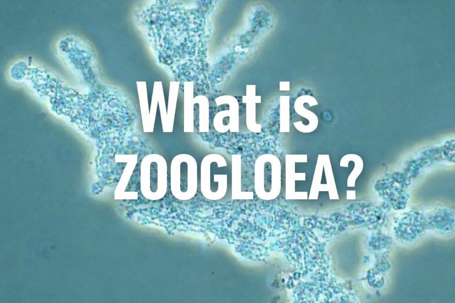 What is Zoogloea?